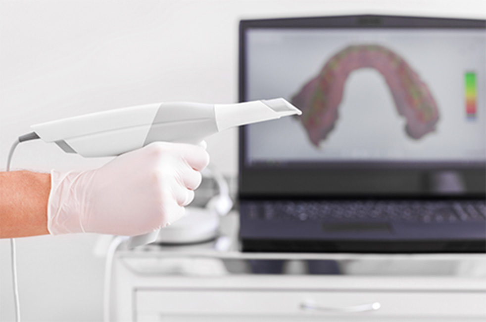 デジタルスキャナー